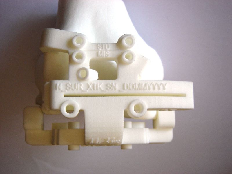 Anterior view of femoral block mounted on femoral model